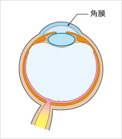 感染性角膜炎