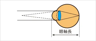 正視