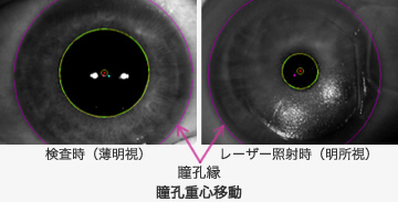 明るさの条件によって異なる瞳孔重心移動